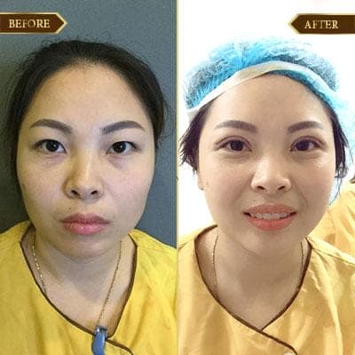 Thu Liên, 32 tuổi, Quảng Ninh