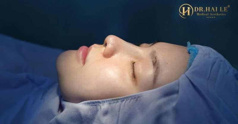 Sở hữu dáng mũi cao thanh tú cùng góc nghiêng hoàn hảo không còn là mơ ước với nâng mũi Demi 5D