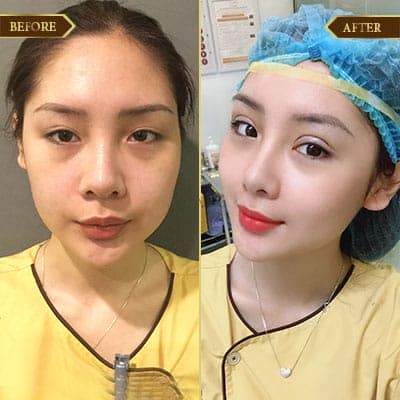 Hoàng Anh, 27 Tuổi, Hải Phòng