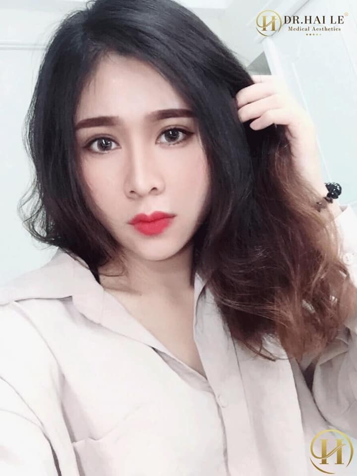 Hot-face Quỳnh Trang: Thẩm mỹ có gì xấu mà phải giấu! Hot-face Quỳnh Trang: Thẩm mỹ có gì xấu mà phải giấu!