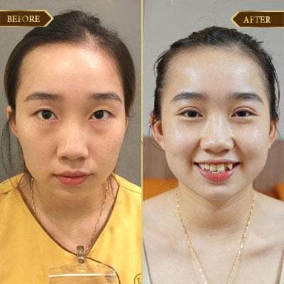 Lê Thị Nữ, 32 tuổi, Lạng Sơn