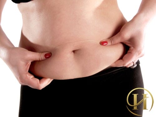 Có cách nào để giảm mỡ bụng lâu năm