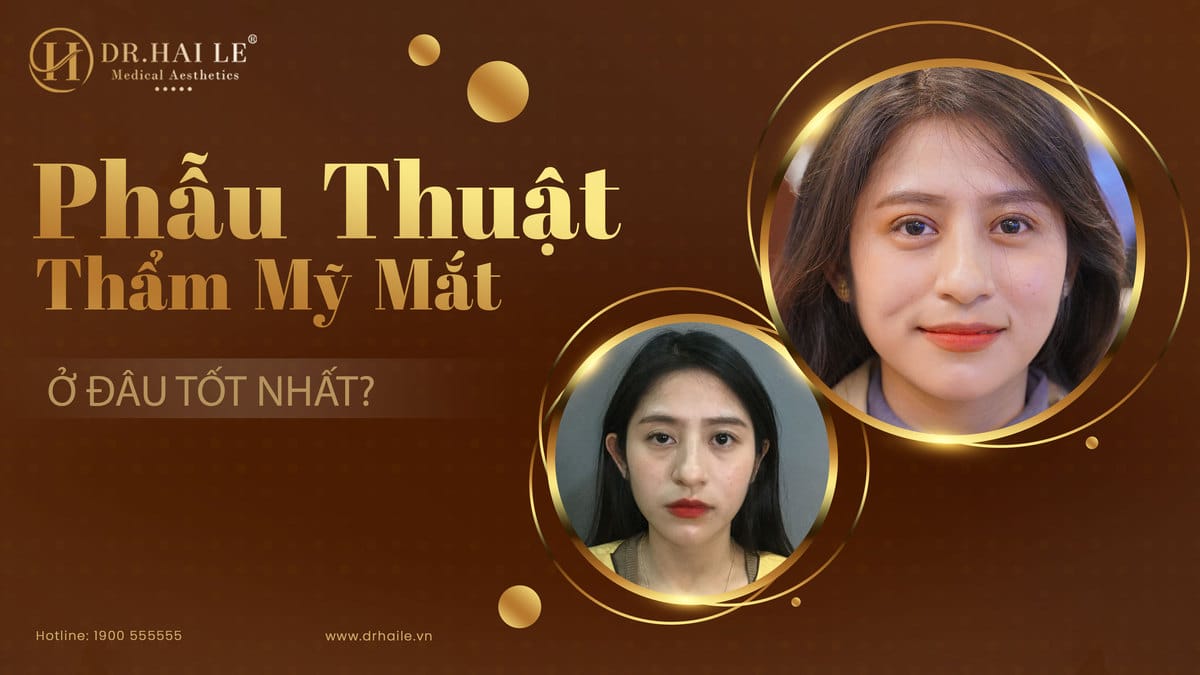 Phẫu thuật thẩm mỹ mắt ở đâu tốt nhất?