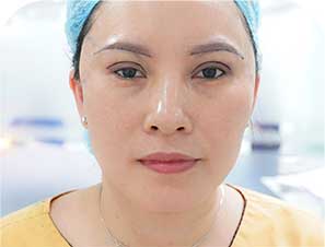 Nâng cung chân mày