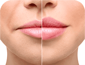 Tạo hình môi trái tim