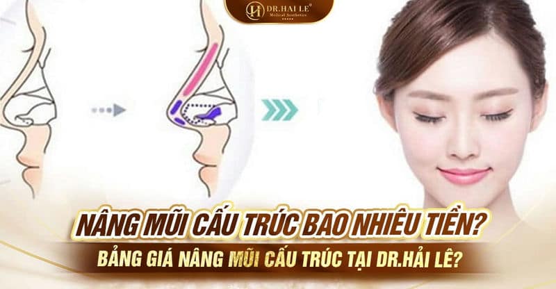 Nâng mũi cấu trúc bao nhiêu tiền? Bảng giá nâng mũi cấu trúc tại Dr.Hải Lê?