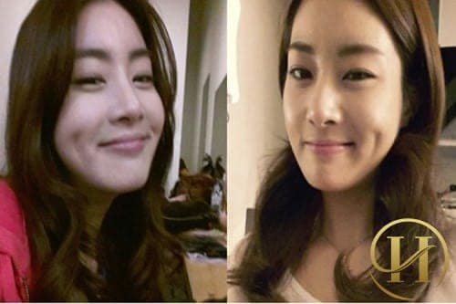 10 sao Hàn "đốn tim" fan vì má lúm đồng tiền 7