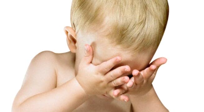 Trẻ bị thâm quầng mắt có nguy hiểm gì đến sức khỏe không?