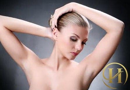 Trị hôi nách bằng hóa chất