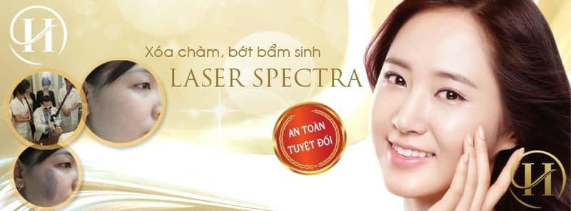 Công nghệ xóa chàm bớt hiệu quả