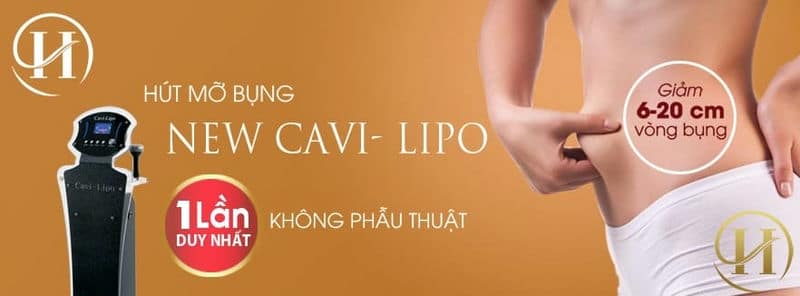 Công nghệ hút mỡ bụng 