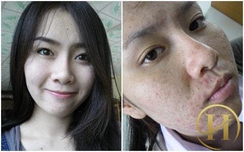 sử dụng kem làm trắng da