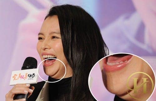 Mặt hai cằm