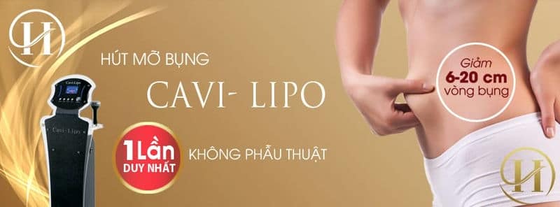 Hút mỡ bụng