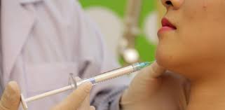  Tiêm Filler vào vùng cằm, điều chỉnh và nâng dáng cằm thon gọn hơn 