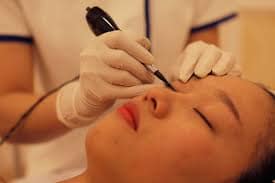  Tiến hành phun mí mắt mở tròng 