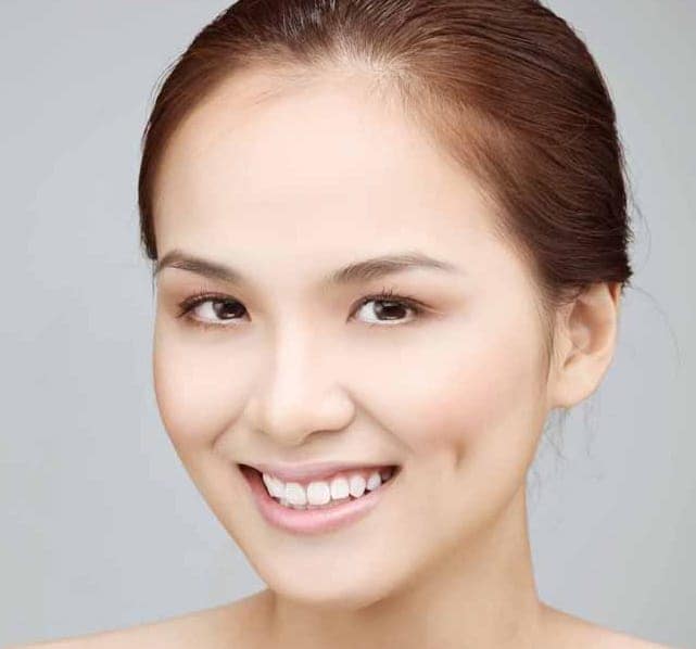 Má có bị sưng sau khi tạo má lúm đồng tiền không?