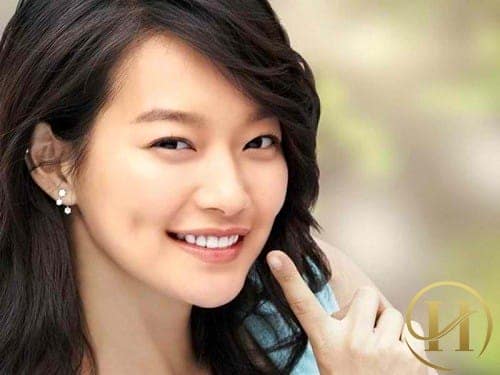 Má lúm đồng tiền