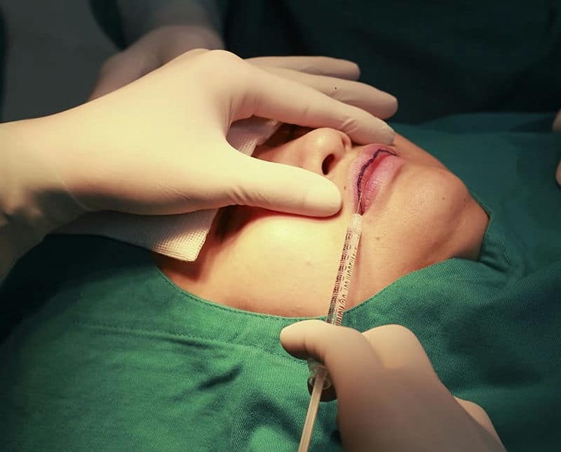 Tiến hành tạo hình môi trái tim