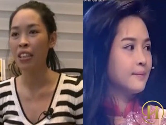 Hot girl thành Nam “gây sốt” với diện mạo mới sau phẫu thuật thẩm mỹ