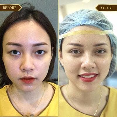 Nguyễn Nhài, 29 tuổi, Bắc Giang