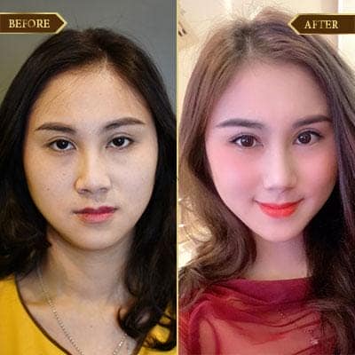 Lưu Thị Mai, 30 tuổi, Quảng Ninh