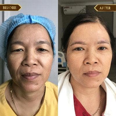 Nguyễn Thị Liễu, 53 tuổi, Hà Nội