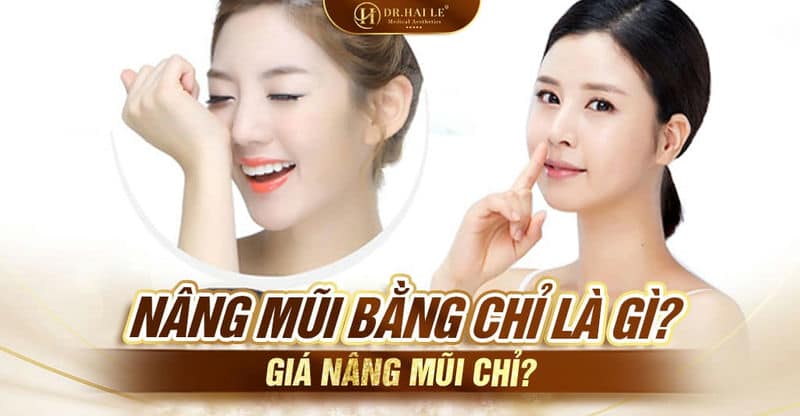 Nâng mũi bằng chỉ là gì? Giá nâng mũi chỉ?
