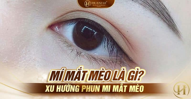 Mí mắt mèo là gì?