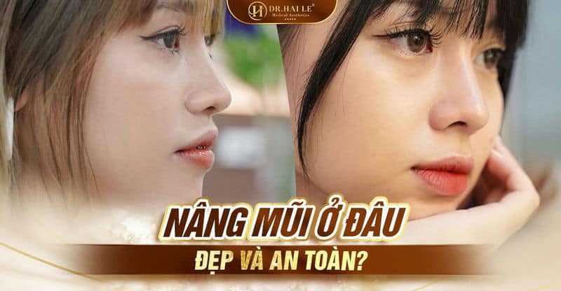 Nâng mũi an toàn tại Dr.Hải Lê
