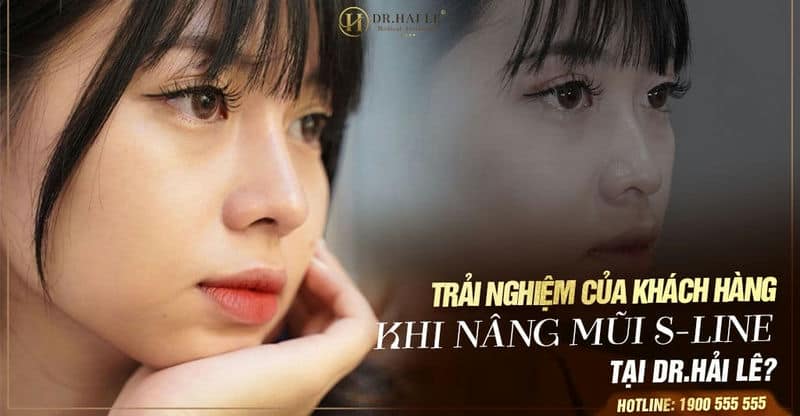 Trải nghiệm của khách hàng khi nâng mũi S-Line tại Dr.Hải Lê?