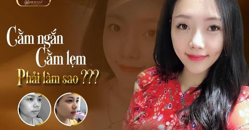 Cằm ngắn, cằm lẹm ư? Đừng lo vì đã có độn cằm v line