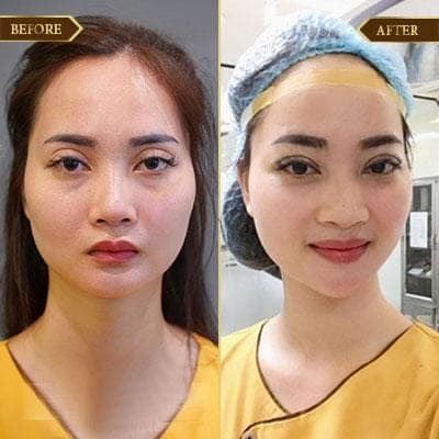 Bích Đào, 25 tuổi, Hà Nội