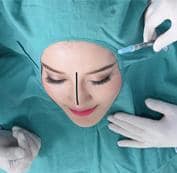  Bước 2: Bác sĩ thăm khăm, đo vẽ dáng mũi mới 