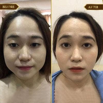 Hà Thị Giang, 32 tuổi, Hà Nội