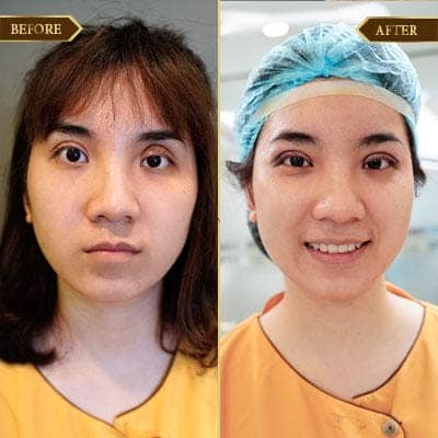 Phạm Hường, 26 tuổi, Hà Nam