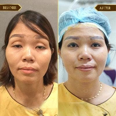 Lê Thị Hạnh, 42 tuổi, Hà Nam