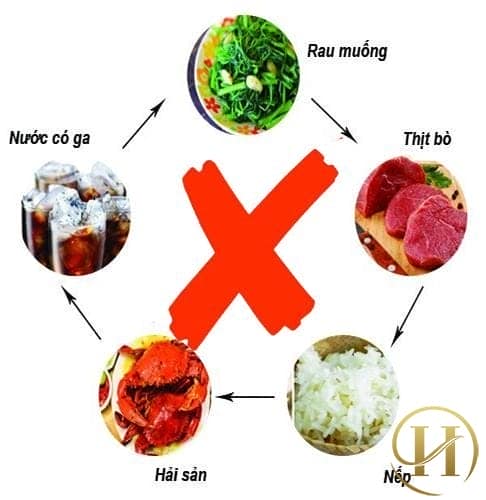 sau khi cắt mí nên kiêng gì?