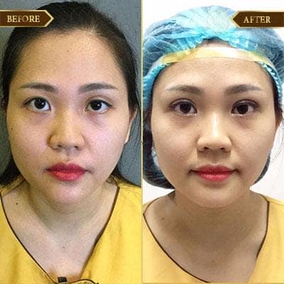 Thùy Anh, 33 tuổi, Quảng Ninh