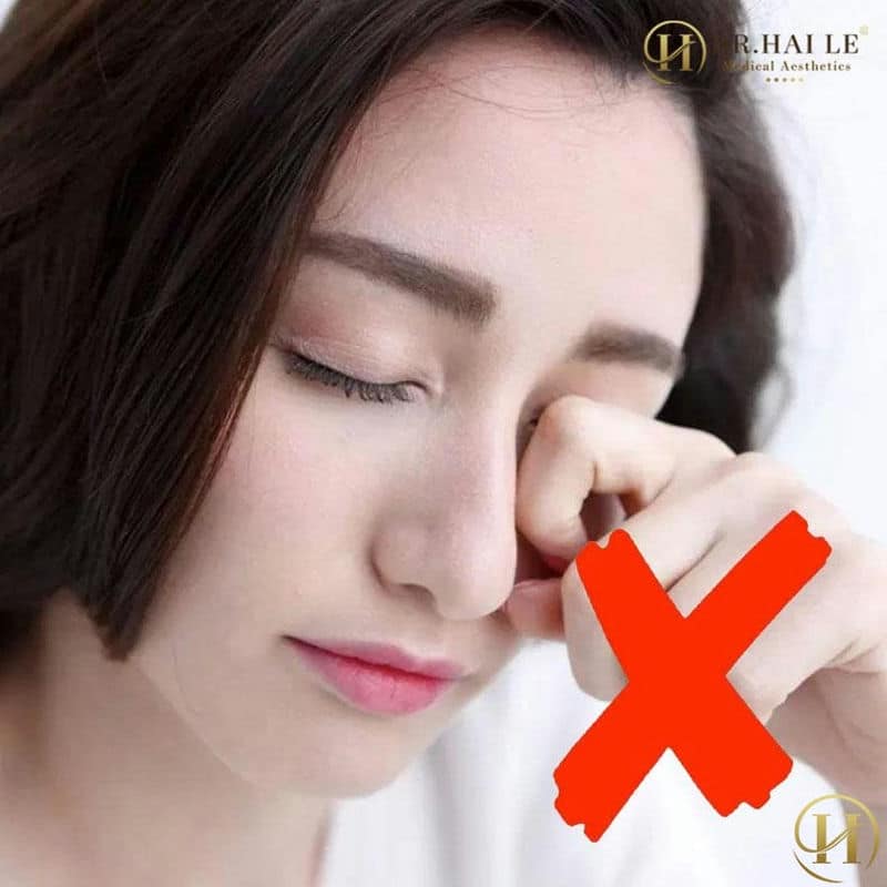 Va chạm mạnh sau khi cắt mí