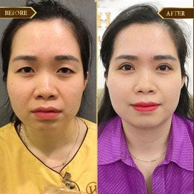 Lê Luyến, 35 tuổi, Hải Phòng