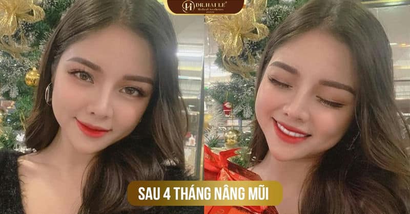 MẪU ẢNH HẢI YẾN VÀ HÀNH TRÌNH CHINH PHỤC DÁNG MŨI MƠ ƯỚC.!!