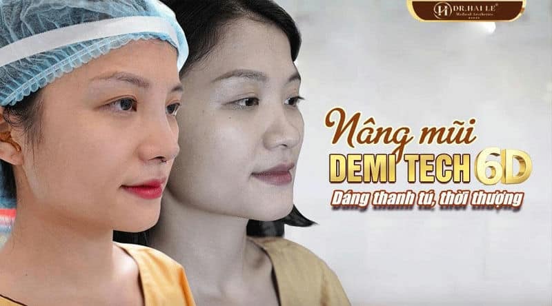 BÍ QUYẾT CỦA HOTGIRL ĐẶNG THANH ĐỂ CÓ MỘT DÁNG MŨI THON GỌN THANH THOÁT