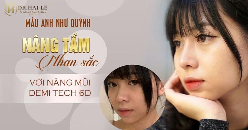 Mẫu ảnh Như Quỳnh nâng tầm nhan sắc với Nâng mũi Demi Tech 6D