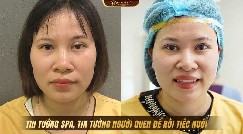 TIN TƯỞNG SPA, TIN TƯỞNG NGƯỜI QUEN ĐỂ RỒI TIẾC NUỐI