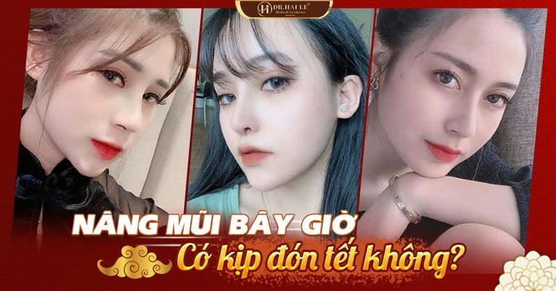 NÂNG MŨI BÂY GIỜ CÓ KỊP ĐÓN TẾT KHÔNG?