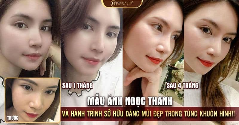 MẪU ẢNH NGỌC THANH và Hành trình sở hữu dáng mũi đẹp trong từng khuôn hình!!️