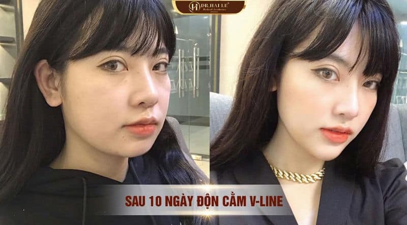 DIỄN VIÊN TỐ UYÊN: “MỘT KẾT QUẢ ĐỘN CẰM TỰ NHIÊN KHIẾN MÌNH RẤT HÀI LÒNG”