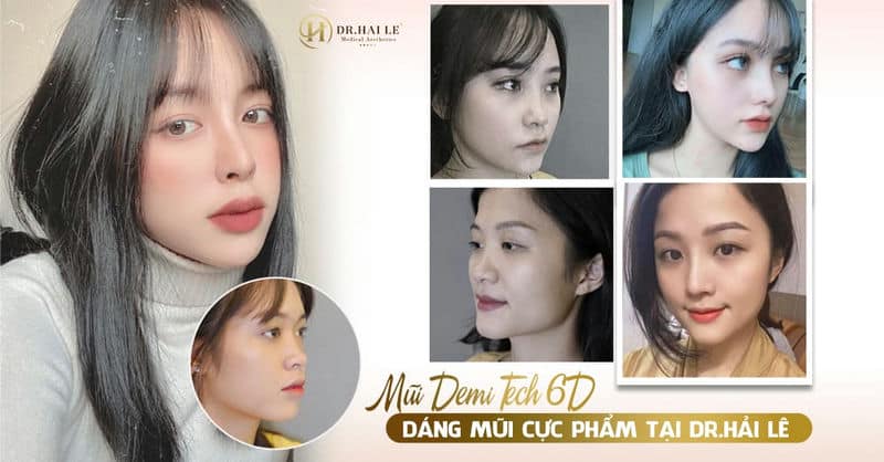 MŨI DEMI TECH 6D - DÁNG MŨI CỰC PHẨM TẠI DR.HẢI LÊ