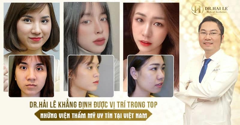 DR.HẢI LÊ KHẲNG ĐỊNH ĐƯỢC VỊ TRÍ TRONG TOP NHỮNG VIỆN THẨM MỸ UY TÍN TẠI VIỆT NAM LÀ DO DÂU?